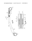 REMOTELY ADJUSTABLE TISSUE DISPLACEMENT DEVICE diagram and image