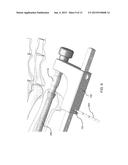 DEVICES AND METHODS FOR BONE FIXATION USING AXIAL IMPLANTS diagram and image