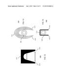 DEVICES AND METHODS FOR BONE FIXATION USING AXIAL IMPLANTS diagram and image