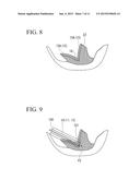 TISSUE RESECTION APPARATUS diagram and image