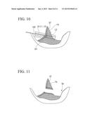 TISSUE RESECTION APPARATUS diagram and image