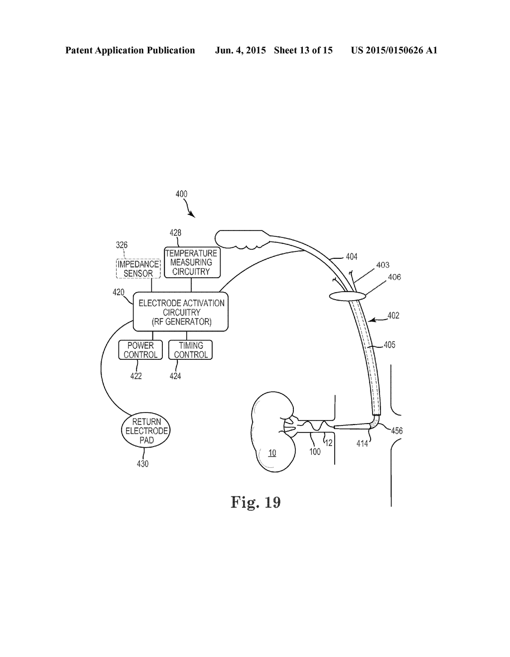 BIPOLAR OFF-WALL ELECTRODE DEVICE FOR RENAL NERVE ABLATION - diagram, schematic, and image 14