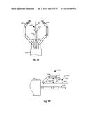 MEDICAL ROBOTIC SYSTEM PROVIDING SENSORY FEEDBACK INDICATING A DIFFERENCE     BETWEEN A COMMANDED STATE AND A PREFERRED POSE OF AN ARTICULATED     INSTRUMENT diagram and image