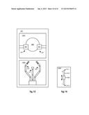 MEDICAL ROBOTIC SYSTEM PROVIDING SENSORY FEEDBACK INDICATING A DIFFERENCE     BETWEEN A COMMANDED STATE AND A PREFERRED POSE OF AN ARTICULATED     INSTRUMENT diagram and image