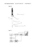 DENTAL TOOL COMPRISING A VERSATILE TIP diagram and image