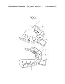 IMPRESSION TRAY SET FOR EDENTULOUS JAW diagram and image