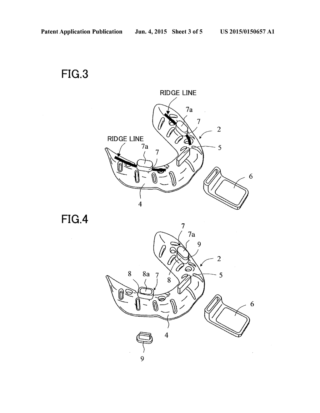 IMPRESSION TRAY SET FOR EDENTULOUS JAW - diagram, schematic, and image 04