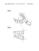 IMPRESSION TRAY SET FOR EDENTULOUS JAW diagram and image