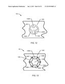 ORTHOPEDIC ANCHORING SYSTEM AND METHODS diagram and image