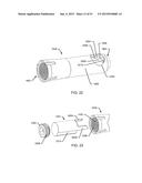 ORTHOPEDIC ANCHORING SYSTEM AND METHODS diagram and image