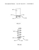 ORTHOPEDIC ANCHORING SYSTEM AND METHODS diagram and image