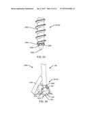 ORTHOPEDIC ANCHORING SYSTEM AND METHODS diagram and image