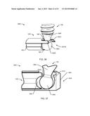 ORTHOPEDIC ANCHORING SYSTEM AND METHODS diagram and image