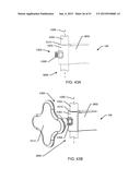 ORTHOPEDIC ANCHORING SYSTEM AND METHODS diagram and image