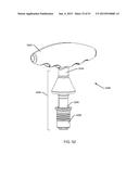 ORTHOPEDIC ANCHORING SYSTEM AND METHODS diagram and image