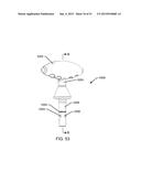 ORTHOPEDIC ANCHORING SYSTEM AND METHODS diagram and image