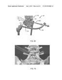 ORTHOPEDIC ANCHORING SYSTEM AND METHODS diagram and image