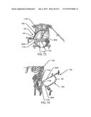 ORTHOPEDIC ANCHORING SYSTEM AND METHODS diagram and image