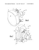 Patient-Specific Glenoid Implant diagram and image