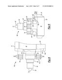 Patient-Specific Glenoid Implant diagram and image