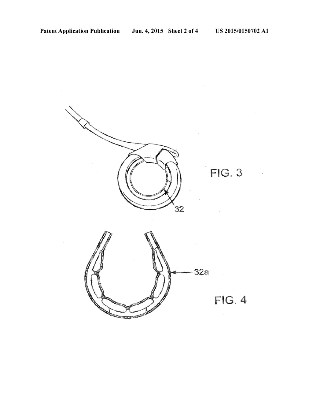 Releasably-Securable One-Piece Adjustable Gastric Band - diagram, schematic, and image 03