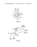 LASER EYE SURGERY SYSTEM diagram and image