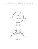 LASER EYE SURGERY SYSTEM diagram and image