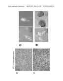 POLYENOLIC ZINC-BINDING AGENTS (PEZBINS) ACTIVELY PROMOTE INACTIVATION OF     CANCER STEM CELLS AND POTENTIATE CYTOTOXIC ANTI-TUMOR DRUG SUBSTANCES diagram and image