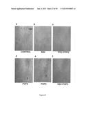 Surfactant Lipids, Compositions Thereof, and Uses Thereof diagram and image