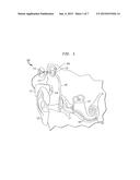 IMPLANTABLE DEVICE HAVING OSSEOINTEGRATING PROTUBERANCES diagram and image