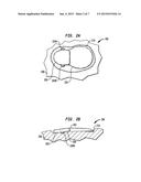 IMPLANTABLE DEVICE HAVING OSSEOINTEGRATING PROTUBERANCES diagram and image