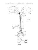 SYSTEM AND METHODS FOR LUNG ISOLATION AND ONE LUNG VENTILATION diagram and image