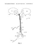 SYSTEM AND METHODS FOR LUNG ISOLATION AND ONE LUNG VENTILATION diagram and image