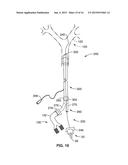 SYSTEM AND METHODS FOR LUNG ISOLATION AND ONE LUNG VENTILATION diagram and image