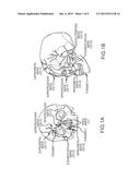 EXTRACRANIAL IMPLANTABLE DEVICES, SYSTEMS AND METHODS FOR THE TREATMENT OF     NEUROPSYCHIATRIC DISORDERS diagram and image