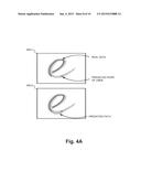 INPUT SYSTEM WITH PARALLEL INPUT DATA diagram and image