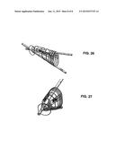 SURGICAL TISSUE PROTECTION SHEATH diagram and image