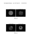 OBJECTIVE QUALITY METRIC FOR OCULAR WAVEFRONT MEASUREMENTS diagram and image