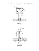 KNOTLESS COLLAPSIBLE SUTURES AND METHODS FOR SUTURING diagram and image