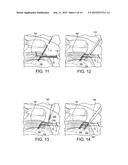 SWIVEL ANCHOR FOR KNOTLESS FIXATION OF TISSUE diagram and image