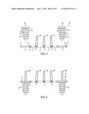 Tissue Repair Suture Plates and Methods of Use diagram and image