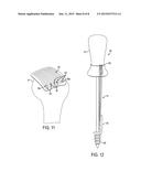 Tissue Repair Suture Plates and Methods of Use diagram and image