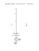 Steerable Endoluminal Punch diagram and image