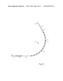 Steerable Endoluminal Punch diagram and image