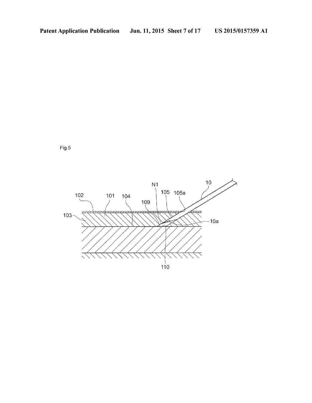 PUNCTURE NEEDLE - diagram, schematic, and image 08