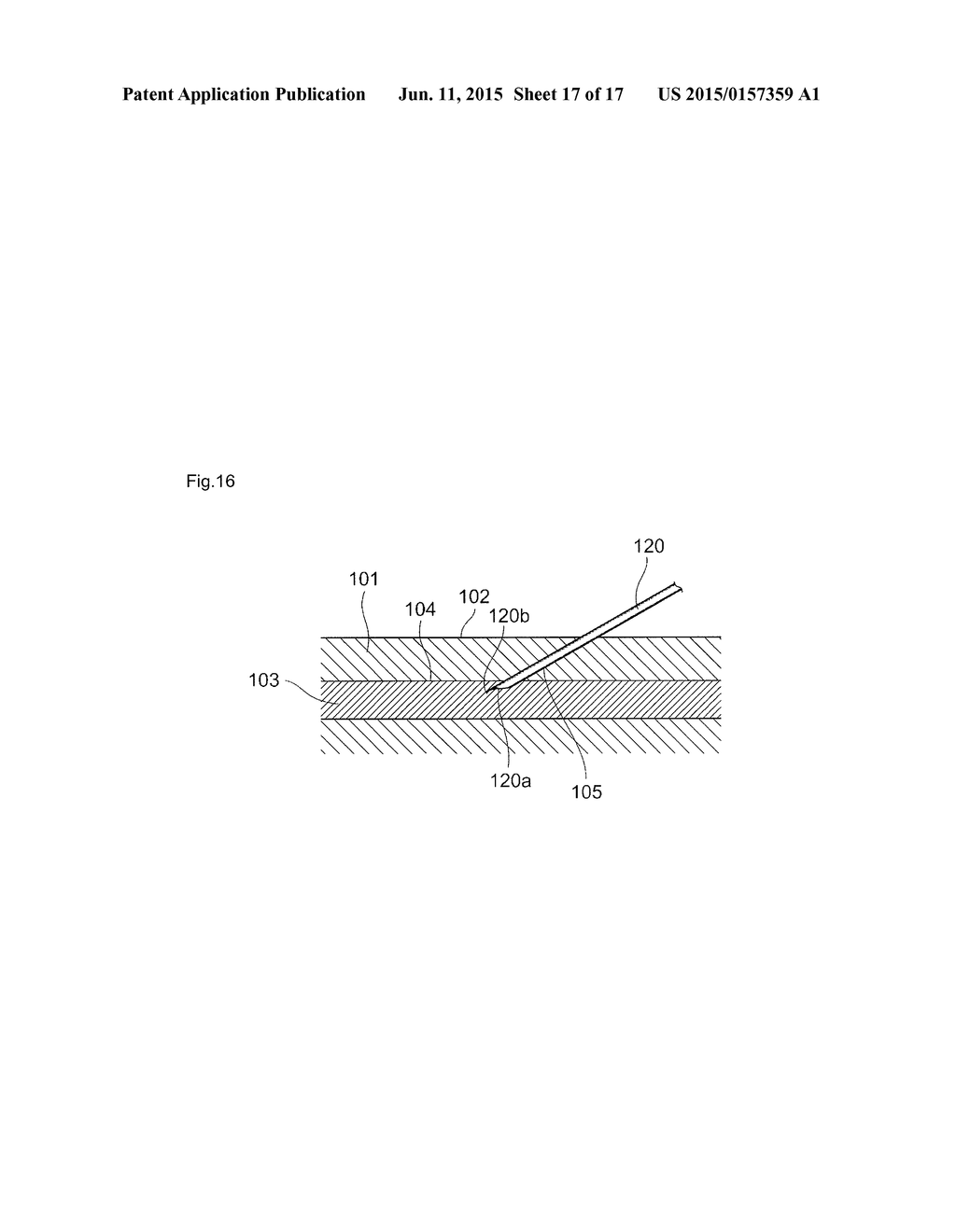 PUNCTURE NEEDLE - diagram, schematic, and image 18