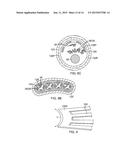 PERICARDIAL CATHETER WITH TEMPERATURE SENSING ARRAY diagram and image