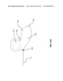 TISSUE VISUALIZATION AND MODIFICATION DEVICES AND METHODS diagram and image