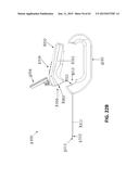 TISSUE VISUALIZATION AND MODIFICATION DEVICES AND METHODS diagram and image