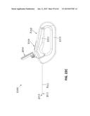 TISSUE VISUALIZATION AND MODIFICATION DEVICES AND METHODS diagram and image